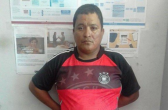 Un hombre es detenido tras agredir con plato de vidrio a su pareja