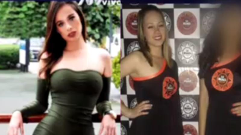 Jossmery Toledo responde aclara el tema de sus cirugías