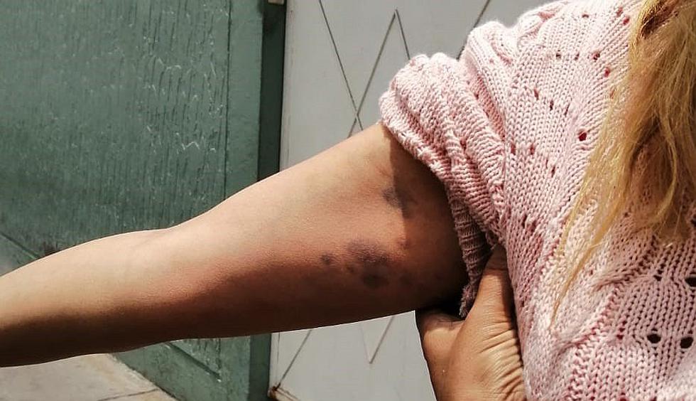Venezolano golpea e intenta apuñalar a estudiante de medicina en Arequipa