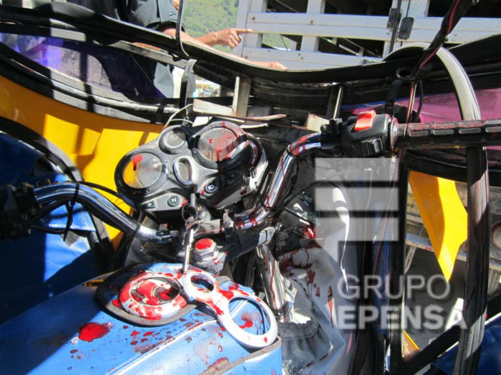 Chofer de motocar se desfigura al impactar unidad con carro lechero (FOTOS)
