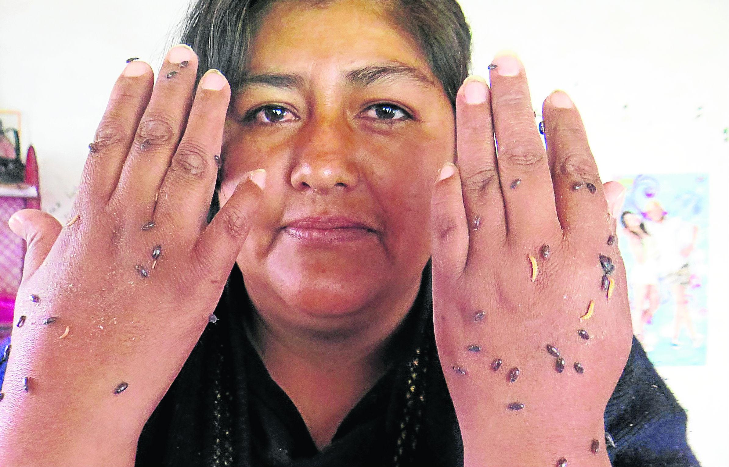 Con gorgojos chinos curandera trata cáncer y otras enfermedades (VIDEO)