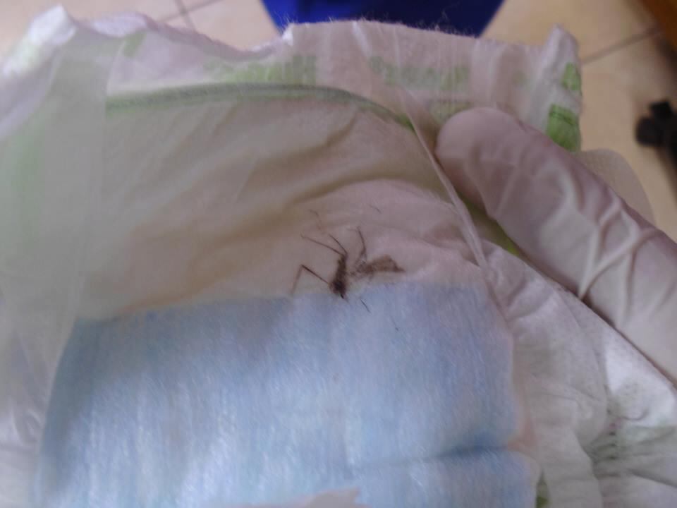 ​Padre de familia encuentra insecto y manchas en el interior de pañales (VIDEO)