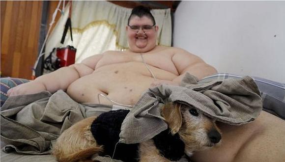 Colocan banda gástrica al hombre más obeso del mundo (FOTOS)