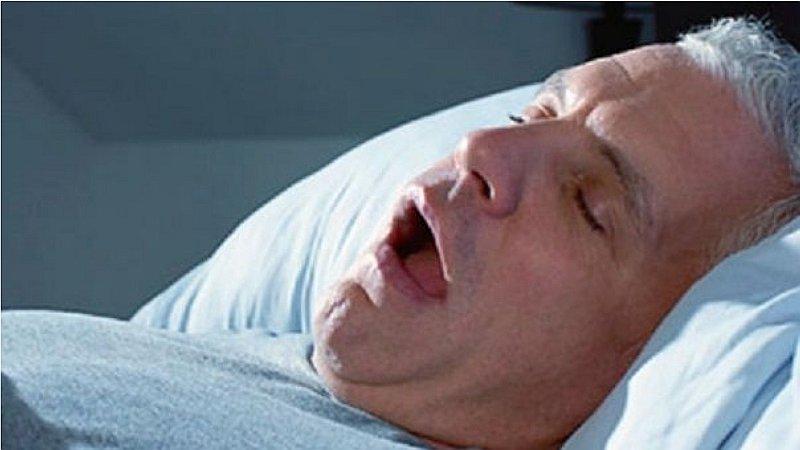 ¿Roncas bastante? Conoce qué es el apnea, la enfermedad que puede ocasionar la muerte