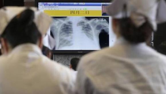 Confirman primera muerte humana por gripe H5N6
