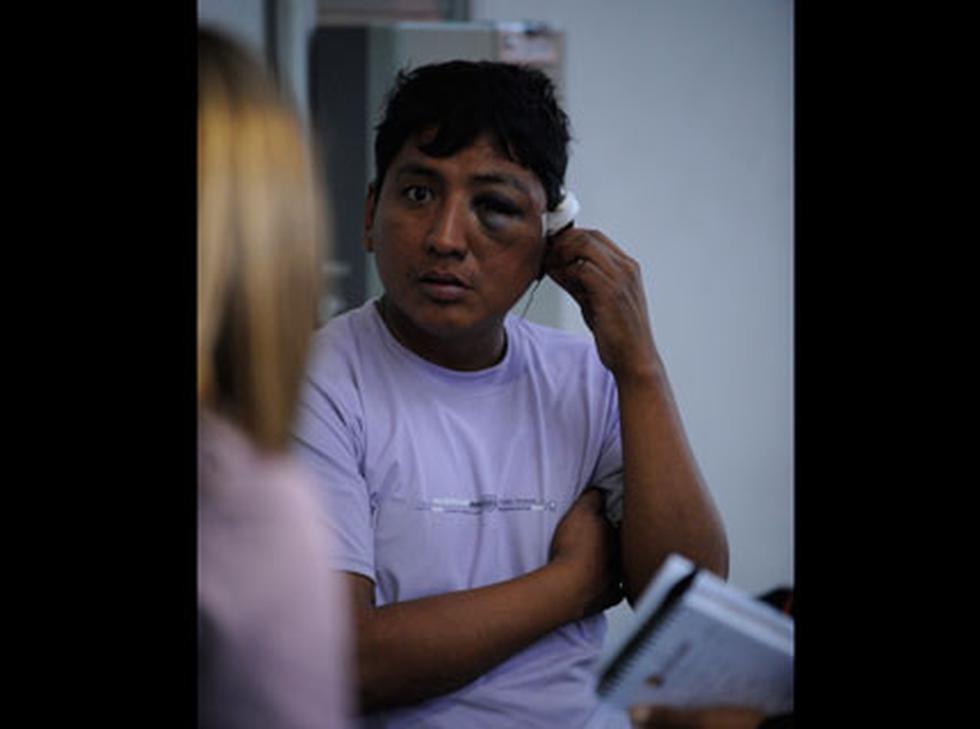 Accidentados en bus interprovincial exigen atención médica