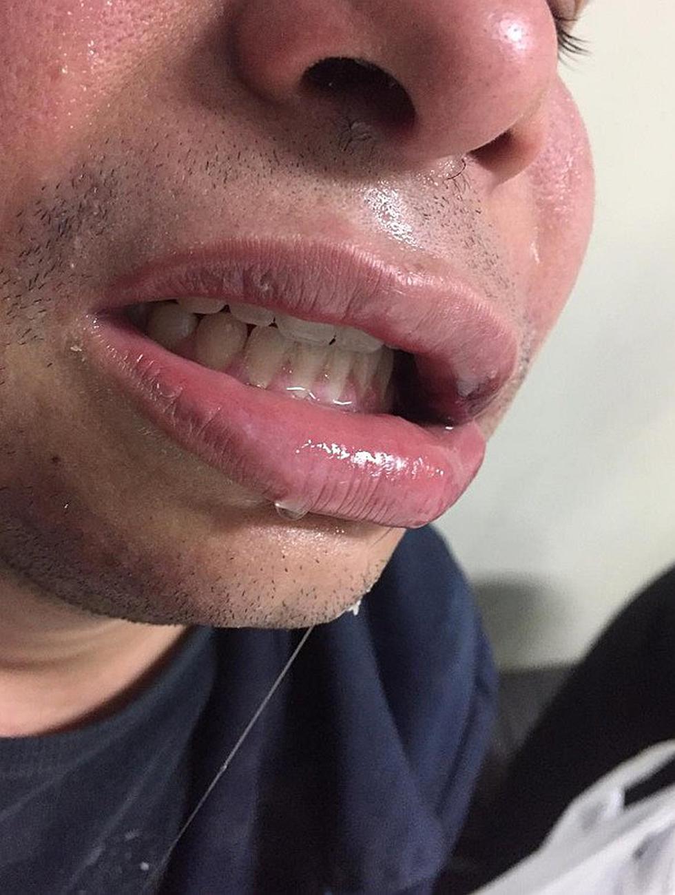 Venezolano es agredido brutalmente por barristas del Sports Boys (FOTOS)