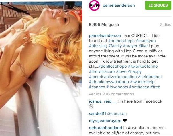  Instagram: Pamela Anderson se desnudó para celebrar que se curó de grave enfermedad [FOTO]