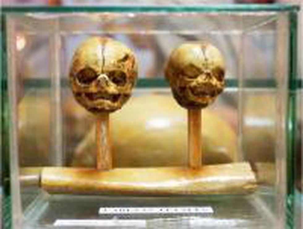 El señor de los huesos