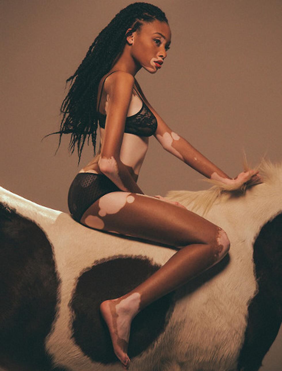 Conoce a la modelo con vitiligo que triunfa en los Estados Unidos (FOTOS)