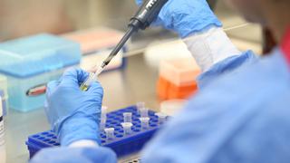 Comisión de Defensa del Consumidor del Congreso revisará las denuncias contra clínicas y laboratorios por cobros de pruebas COVID-19