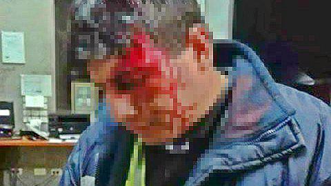 Siete delincuentes roban en el peaje de Puquio y dejan herido a administrador