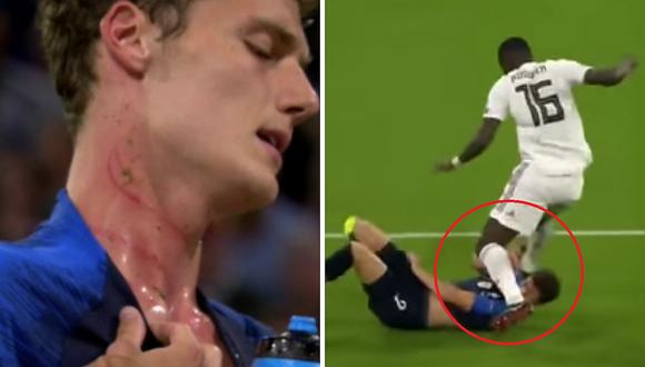 Benjamin Pavard sufre terrible herida en el cuello tras pisotón de defensor alemán (FOTO Y VÍDEO)