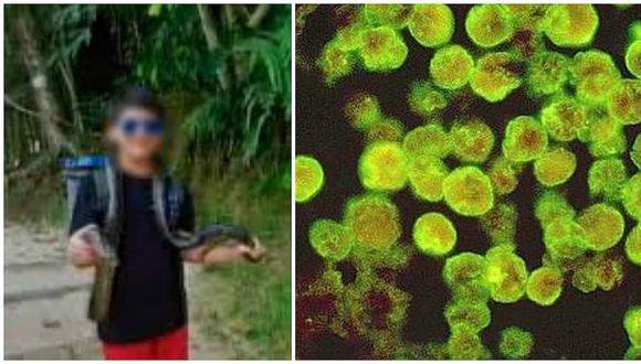 Ameba "come cerebros": estos son los síntomas de enfermedad que ya mató a 4 niños en el Perú
