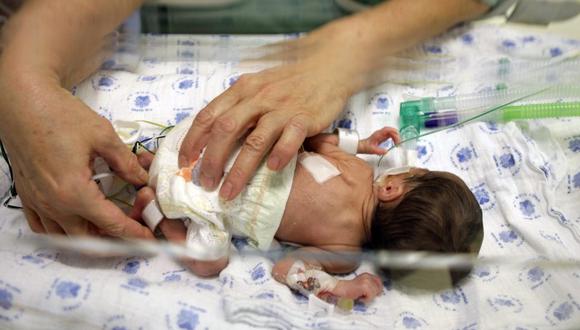 Francia: Un antiepiléptico provocó malformaciones en 450 recién nacidos