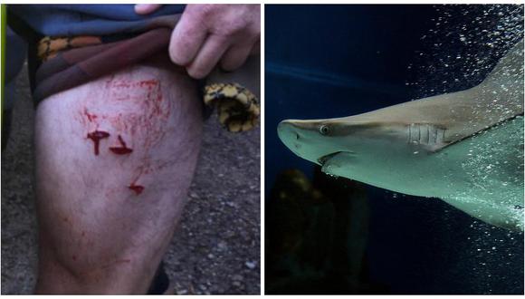 Tiburón ataca a surfista en una playa y esto fue lo que salvó su vida 