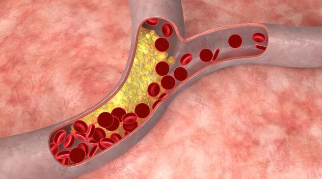 Ciencia: “Nano-drones” para combatir colesterol en la sangre