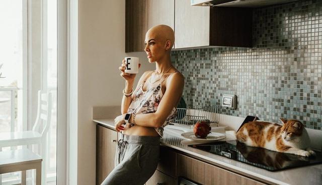 Anahí de Cárdenas sobre medicamento que consume tras quimioterapia: “Me estaba dejando ciega” (Foto: Instagram)