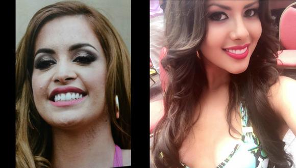Miss Perú: ¿La novia de Mauricio Diez Canseco fue contagiada por Milett Figueroa? 
