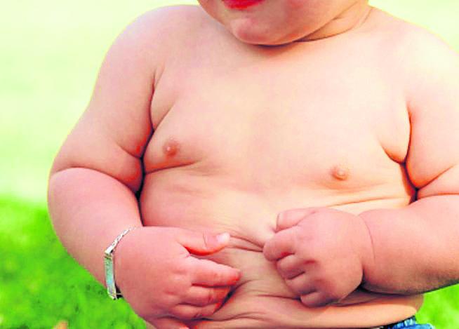 La obesidad y el sobrepeso agobia a miles por mala alimentación