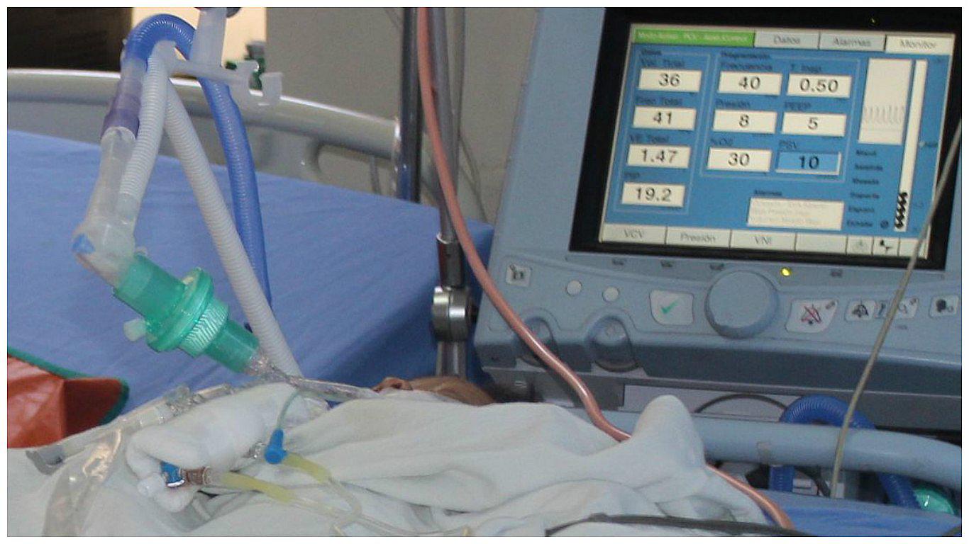 Bebe hermafrodita nace en hospital 'El Carmen' de Huancayo