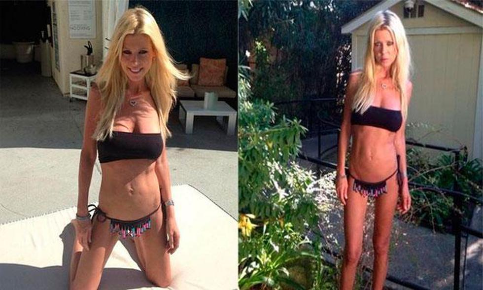 Tara Reid de American Pie impacta por su extrema delgadez (FOTOS)