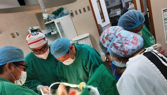 Médicos del Seguro Social de Salud (EsSalud) en Cusco, realizaron una cirugía reconstructiva de la fístula traqueoesofáfica a paciente de 49 años. Foto: EsSalud