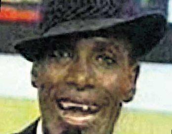 Explica caída de sus dientes