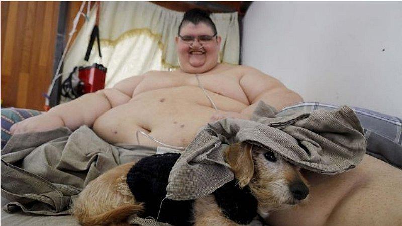 Colocan banda gástrica al hombre más obeso del mundo (FOTOS)