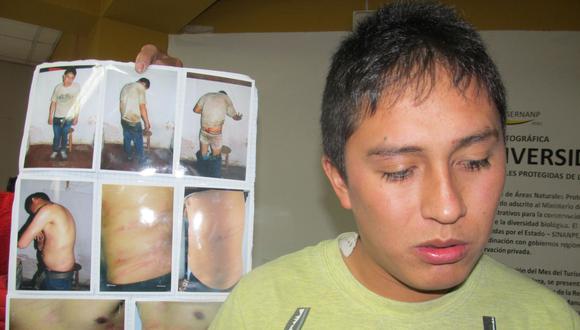 Cusco: Estudiante denuncia haber sido golpeado por serenos de la municipalidad de Urubamba (VIDEO)