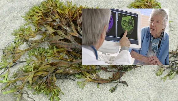 China aprueba medicamento contra el Alzheimer compuesto por algas marinas
