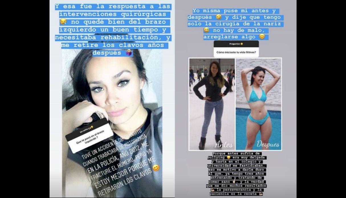 Jossmery Toledo habla sobre sus descansos médicos y su antes y después (Instagram)
