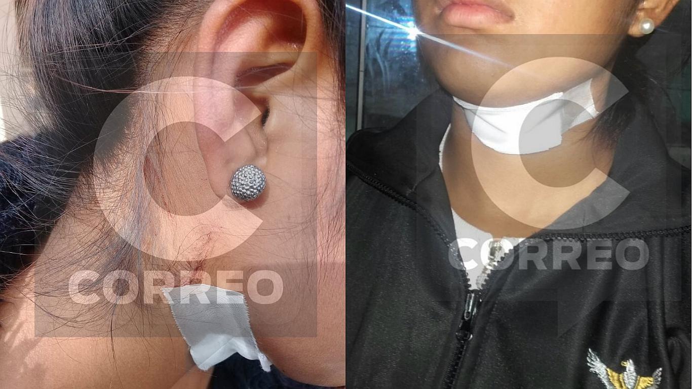 Joven queda grave luego de que delincuente le cortara el cuello para asaltarla 