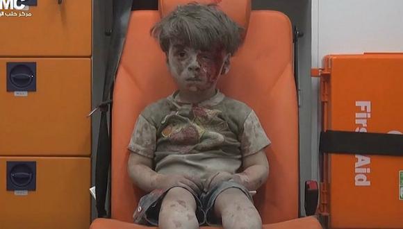 Medios chinos creen que video de niño sirio herido podría ser falso