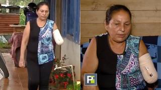 Hombre corta el brazo de su madre con un machete e intenta matar a su padrastro (VIDEO)