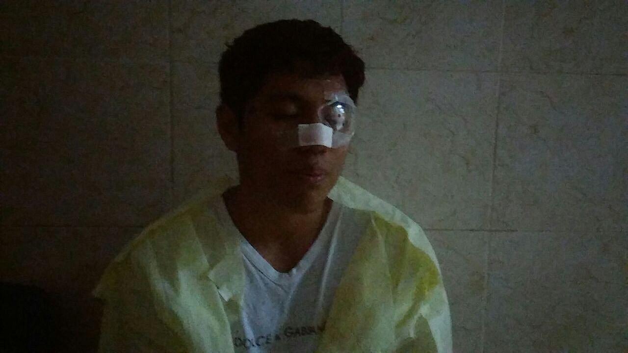 ​Universitario que recibió proyectil en protesta podría perder vista del ojo izquierdo (VIDEO)