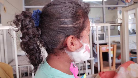 Los padres de la pequeña Allison (4) requieren que se haga justicia luego del ataque de la jauría en un conocido centro comercial de Tacna. (Foto: Difusión)