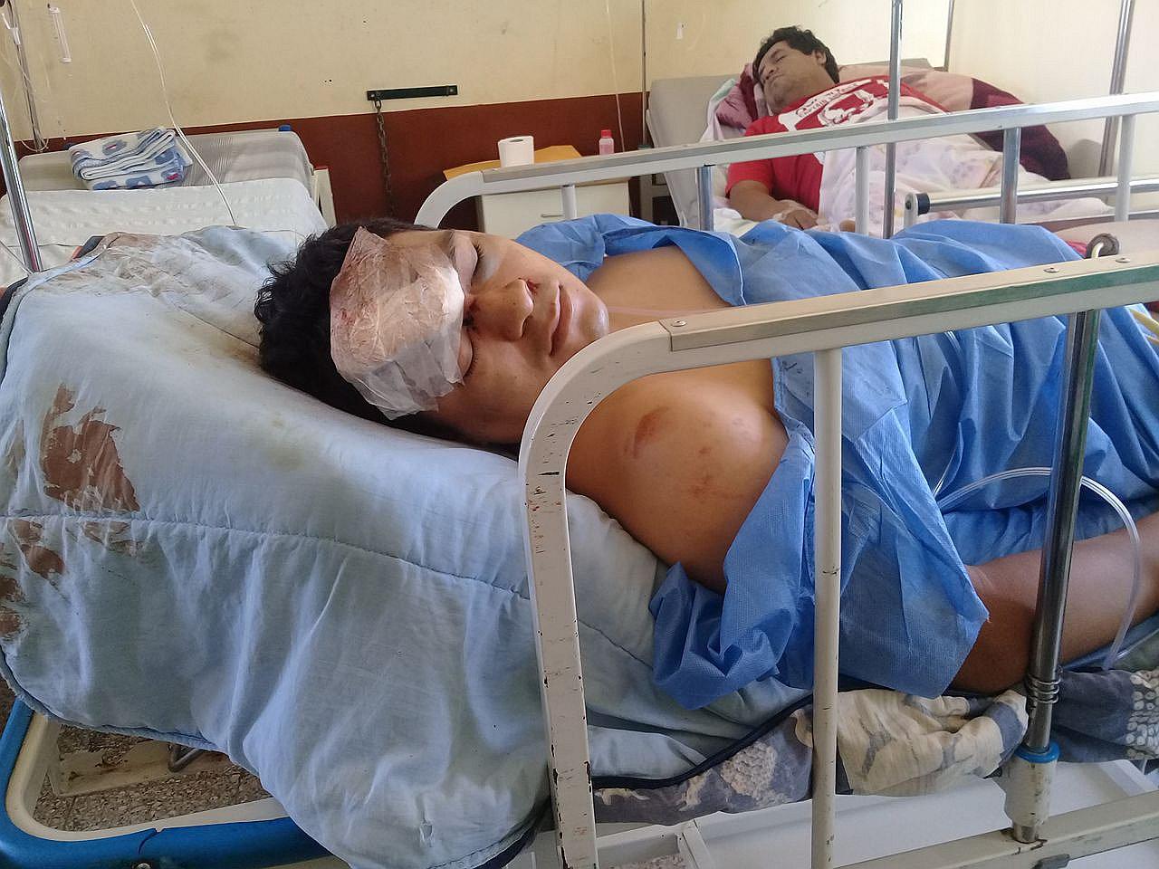 Chimbote: Joven queda grave tras despiste de su motocicleta