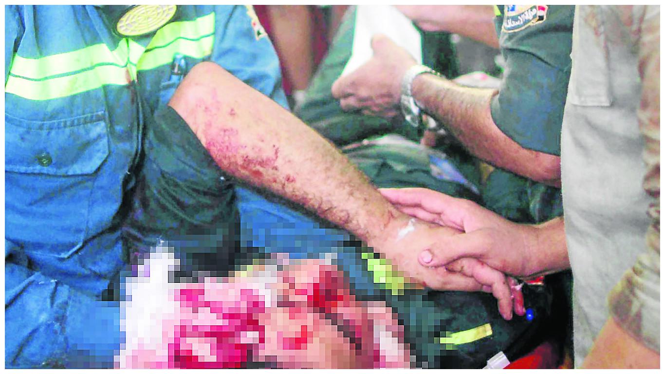 Amoladora le destroza el rostro a trabajador 