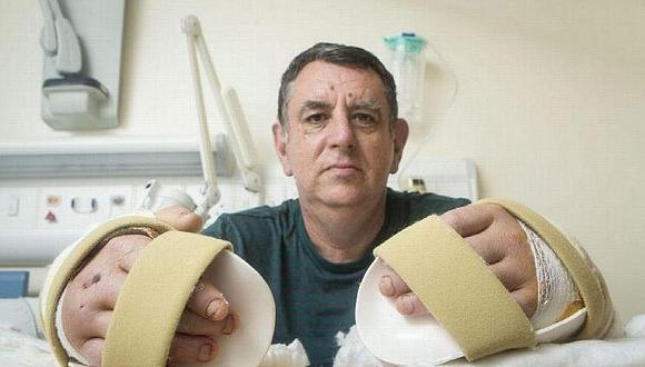 ​Reino Unido: realizan con éxito el primer trasplante de dos manos