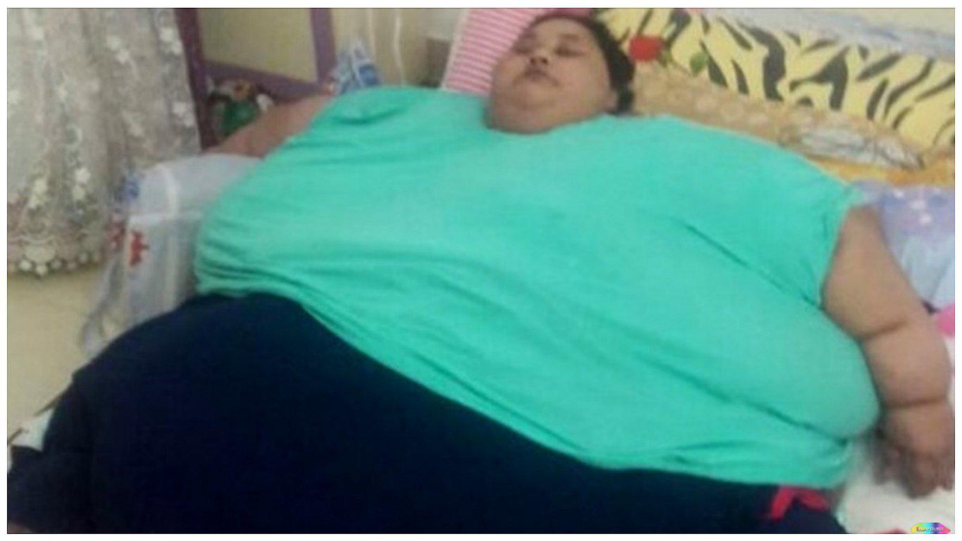 India: la mujer más obesa del mundo perdió 100 kilos tras ser operada 