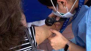 Detectan más de mil casos de males a la piel en hospitales de Huancayo