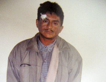 Chanchero "Chito" recibe tres balazos en la cara