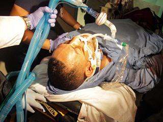 "Macho" Camacho con muerte cerebral 