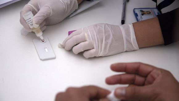 El medicamento “reduce la cantidad de VIH en el organismo, manteniéndolo en un nivel bajo”, recalca Anvisa. (Foto: Claudio Reyes / AFP)