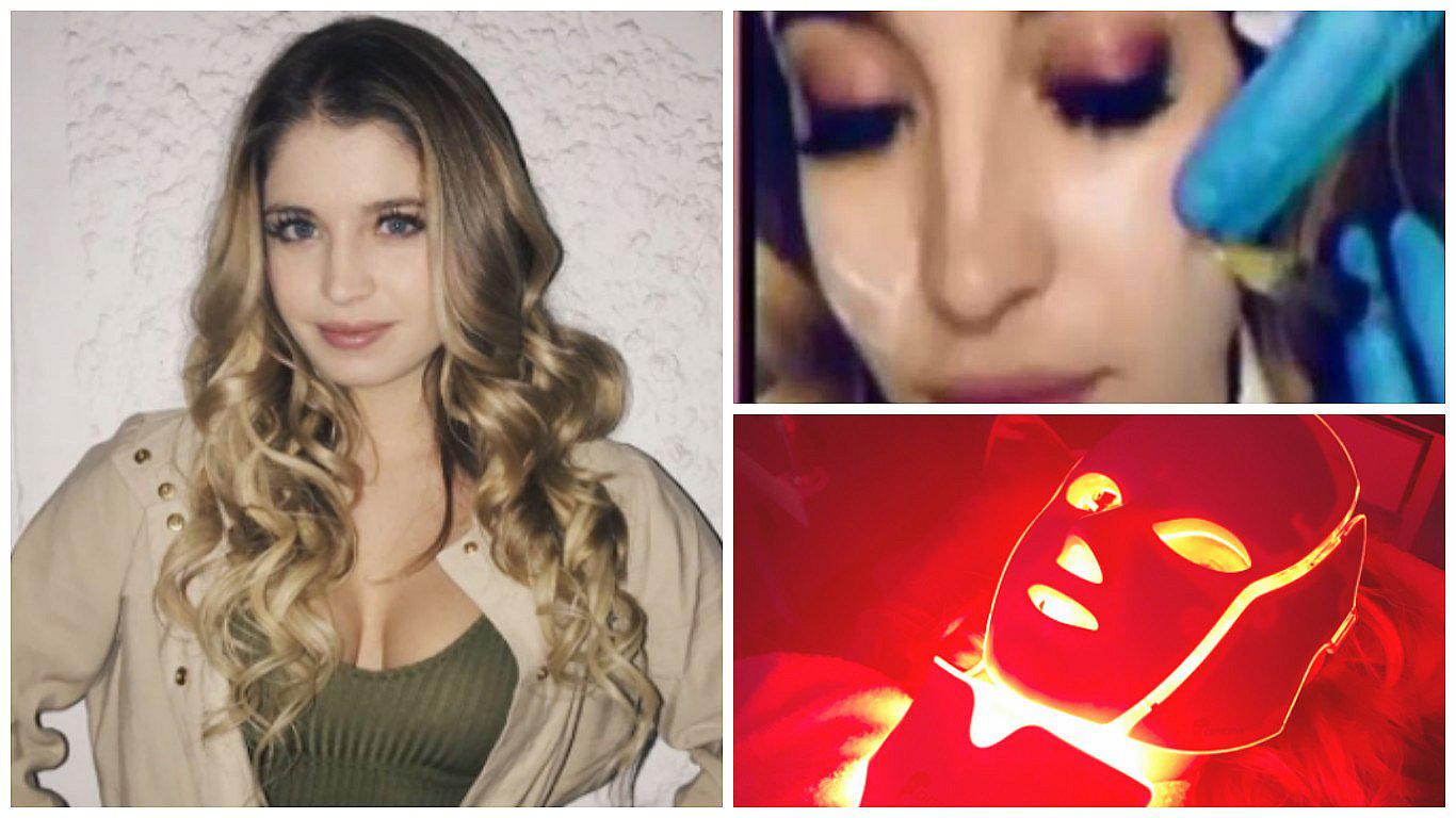 Flavia Laos tiene 19 años, se inyecta en la cara y recurre a tratamientos con láser (VIDEOS)