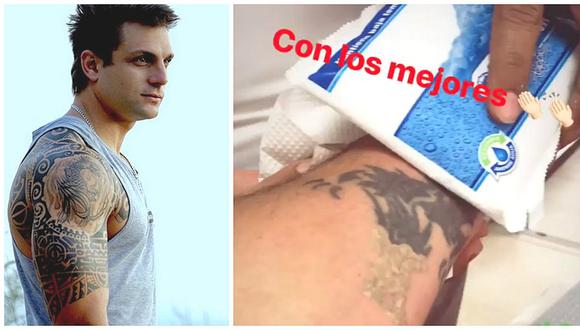 Nicola Porcella muestra cómo quedó su brazo tras borrarse un tatuaje (VIDEO)
