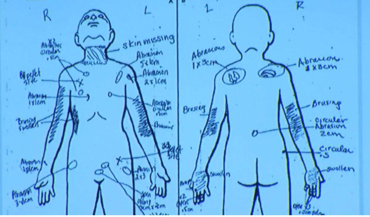 “Cada centímetro de Gabriel estaba magullado e hinchado. Su piel era de color negro y azul”, declaró en el juicio Emily Rebar, una de las enfermeras que atendió al niño antes de morir. (Foto: Unvision)