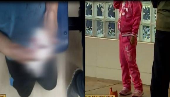 Niño de 7 años casi pierde su mano en estación del tren eléctrico (VIDEO)