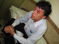 Agreden a reportero de canal tumbesino